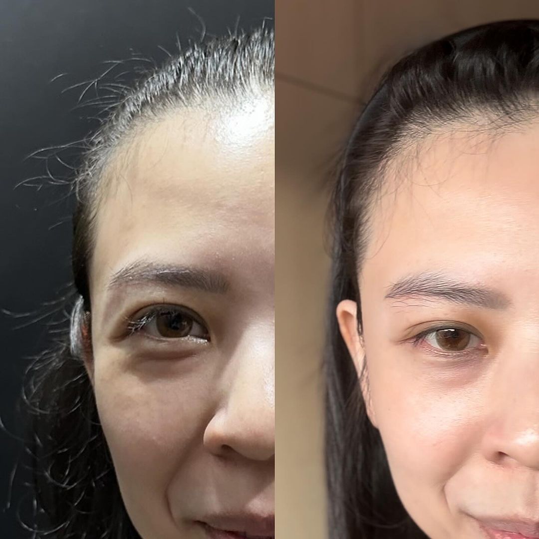 Artisan Follicle Fortify